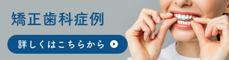 矯正歯科症例